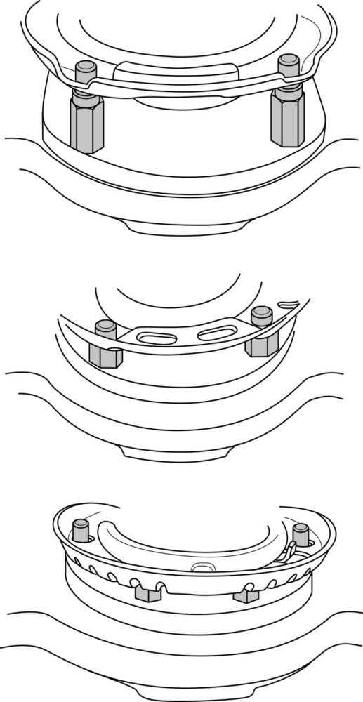 Upgrade Kit, VW-Audi, Size 1 + 2 + 3