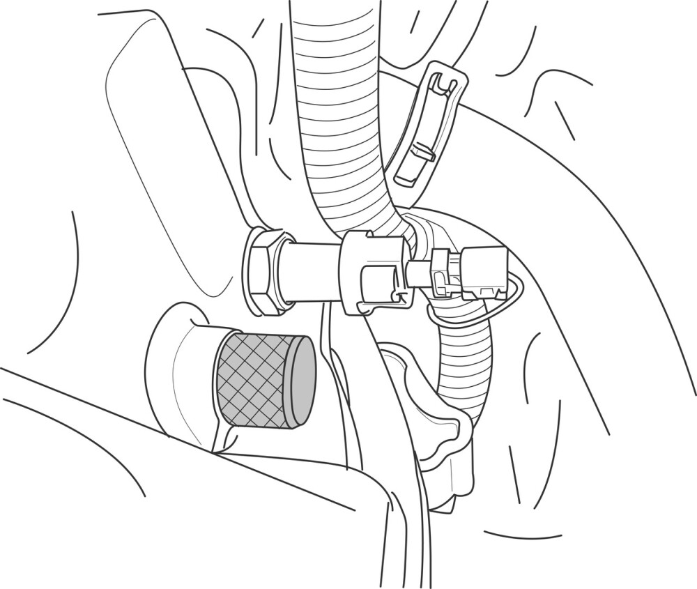 Locking Tool Set, Renault
